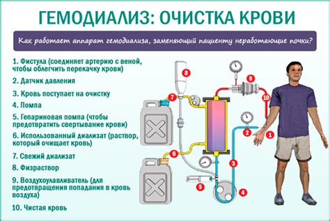 Принцип работы стенда почки