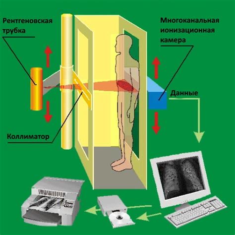 Принцип работы флюорографического аппарата