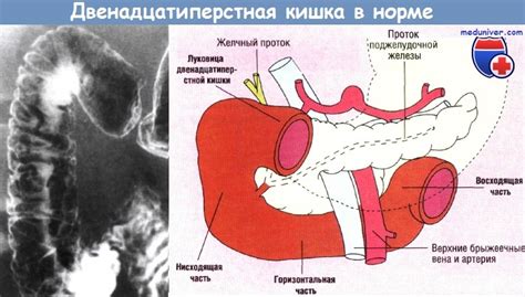 Причина гиперемии слизистой двенадцатиперстной кишки