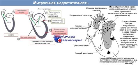 Причины Нмк 1 степени в кардиологии