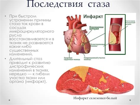 Причины венозного стаза