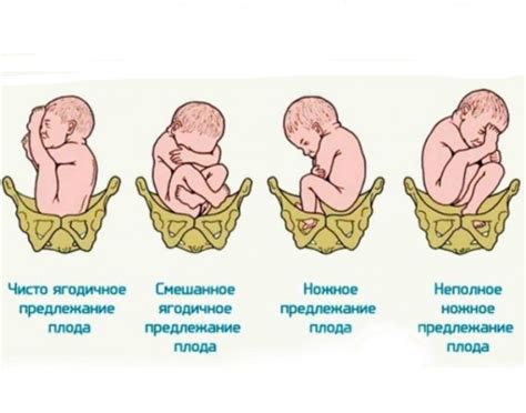 Причины водянки у мальчиков