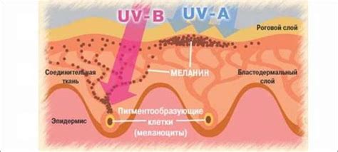 Причины возникновения белого ореола вокруг родинки