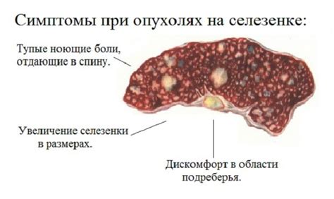 Причины возникновения гиподенсного очага в селезенке