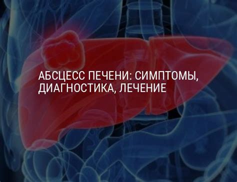 Причины возникновения гиподенсного участка в печени