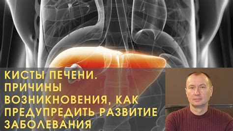 Причины возникновения кисты печени у мужчин