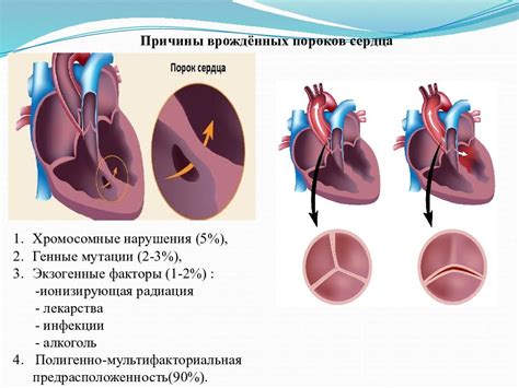 Причины возникновения компенсированных пороков сердца