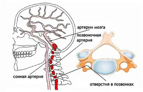 Причины возникновения малого диаметра позвоночной артерии