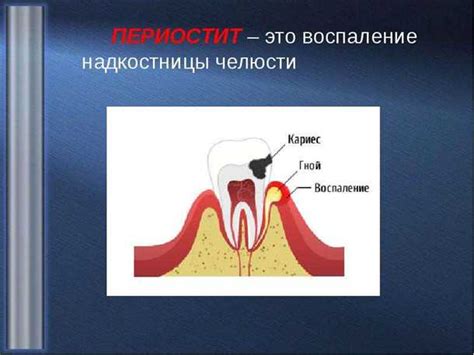 Причины возникновения надкостницы