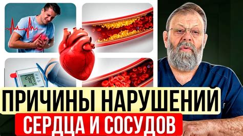 Причины возникновения нарушений полнокровия сосудов