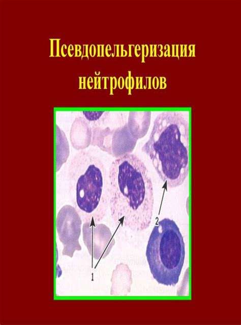 Причины возникновения нейтрофильного лейкоцитоза со сдвигом влево