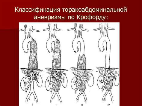 Причины возникновения неоперабельной аневризмы аорты