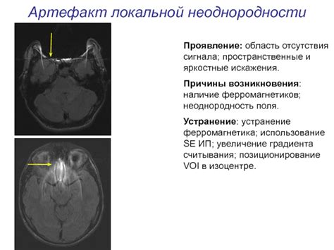 Причины возникновения сигнала "занято"