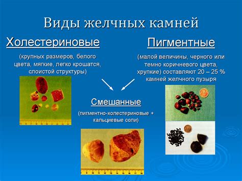 Причины возникновения черной желчи