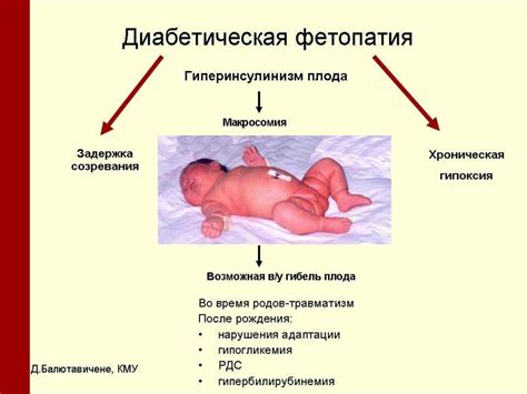 Причины возникновения эксцентричного отхождения пуповины