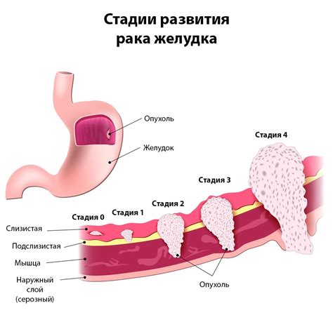 Причины всталого желудка у взрослого