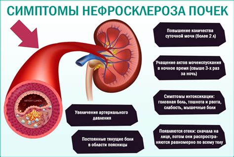 Причины и лечение нефросклероза