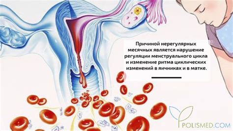 Причины и последствия нерегулярных месячных