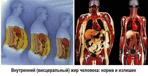 Причины и последствия получения огнестрельных повреждений в области живота