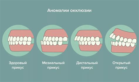 Причины и рекомендации при износе и потере зубов