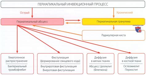 Причины и факторы развития интеркуррентных инфекций