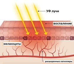 Причины и факторы риска солнечного ожога у маленького ребенка