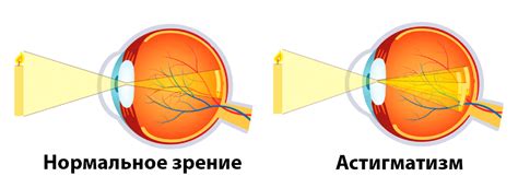 Причины ленивых глаз у взрослых