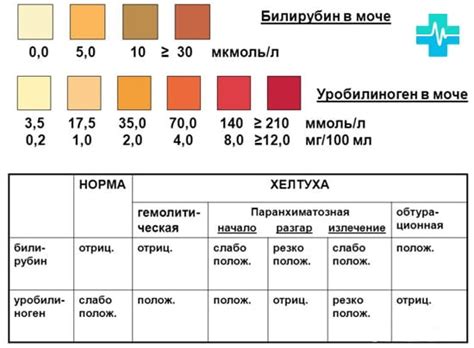 Причины наличия уробилина в моче