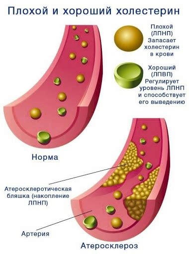 Причины нарушения липидного обмена