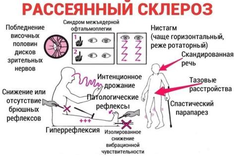 Причины нарушения функций вестибулярного аппарата