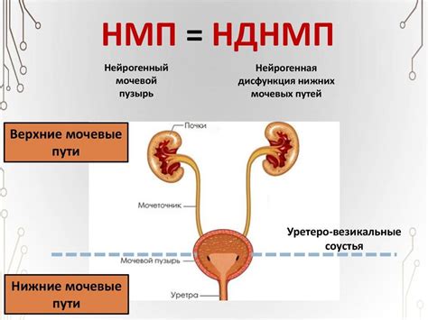 Причины нейрогенной дисфункции мочевого пузыря у детей