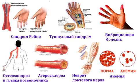 Причины немощи рук у человека и методы ее лечения