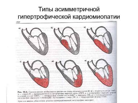 Причины неравномерного расширения у взрослых: приобретенные факторы