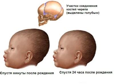 Причины неровной головы у грудничка