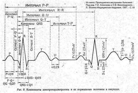 Причины низкого вольтажа на ЭКГ отведений от конечностей