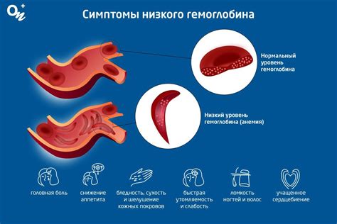 Причины низкого гемоглобина