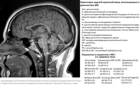 Причины низкого расположения миндалин мозжечка