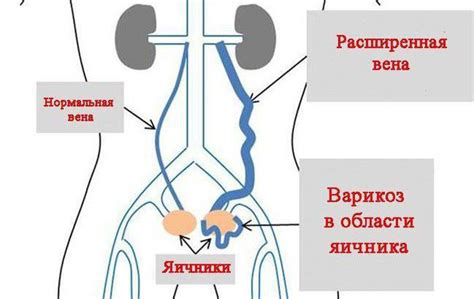 Причины низкого таза