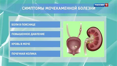 Причины образования оксалатов в моче