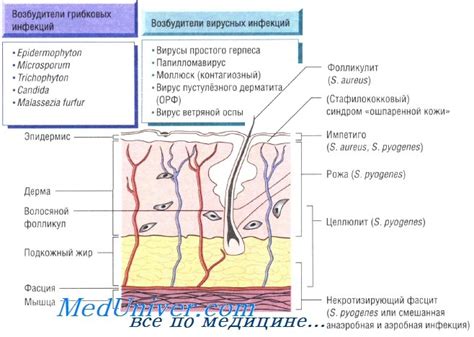 Причины обызвествления мягких тканей