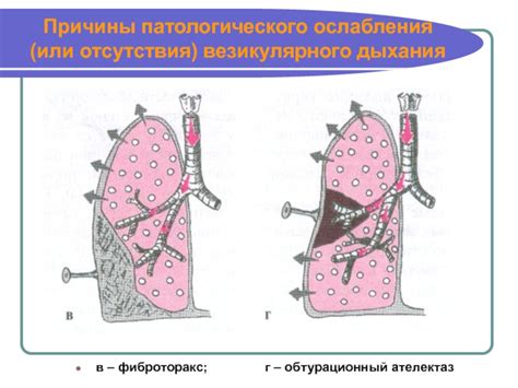 Причины отсутствия патологического метаболизма ФДГ