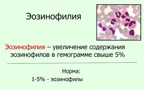 Причины повышенных эозинофилов у собаки