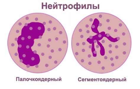 Причины понижения палочкоядерных нейтрофилов