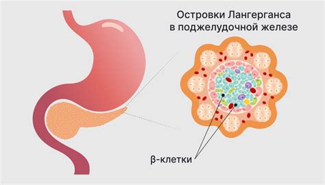 Причины пониженного уровня инсулина в крови