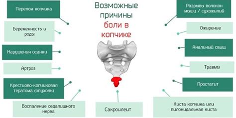 Причины появления боли в копчике