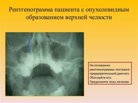 Причины появления снов с опухолевидным образованием под подмышечной впадиной