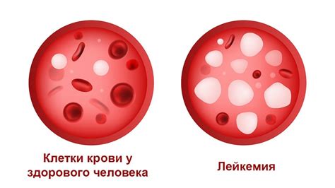 Причины появления сры крови у человека