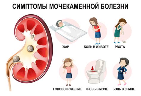 Причины появления чайно-цветной мочи