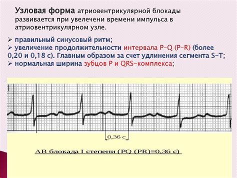 Причины преходящей ав блокады 1 степени