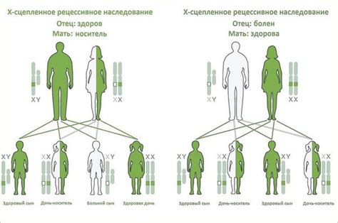 Причины развития ПМК 1 степени без регургитации